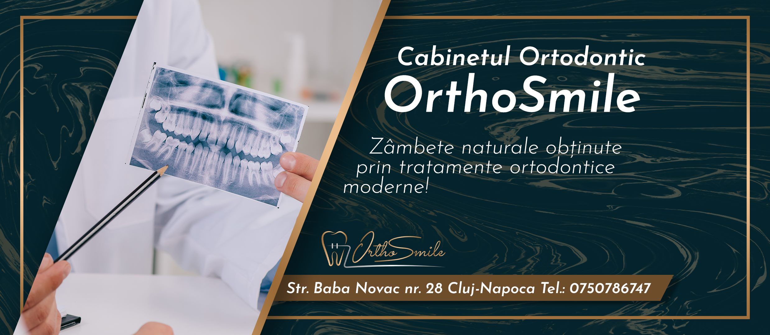 cabinet ortodontic cluj -Orthosmile